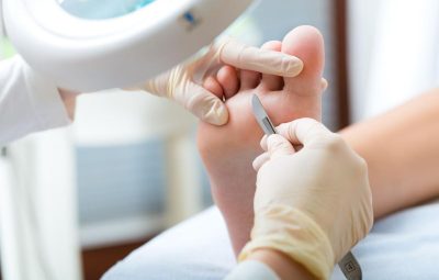 callosites et cors traitement pedicure podologie nyon